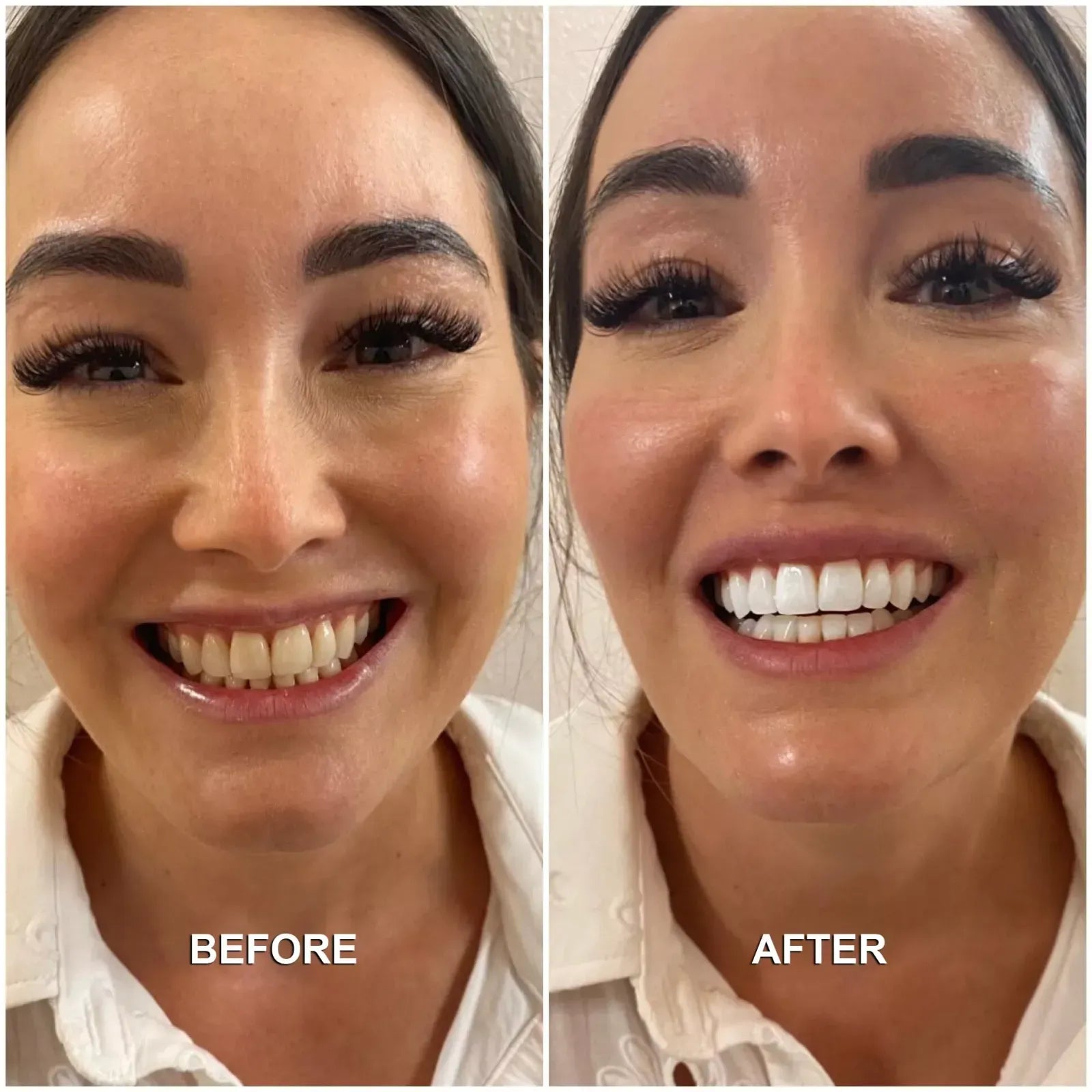 PlaqueLifter Ultrasonic Tooth Cleaner